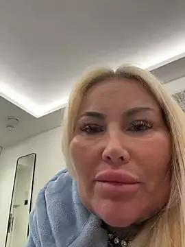 Candy-RoseUK — Lip filler and  Botox